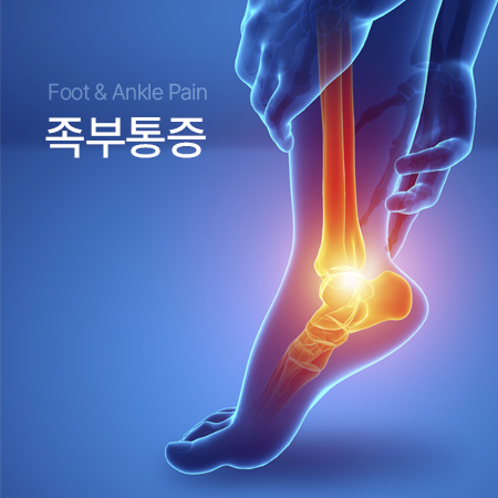 족부통증